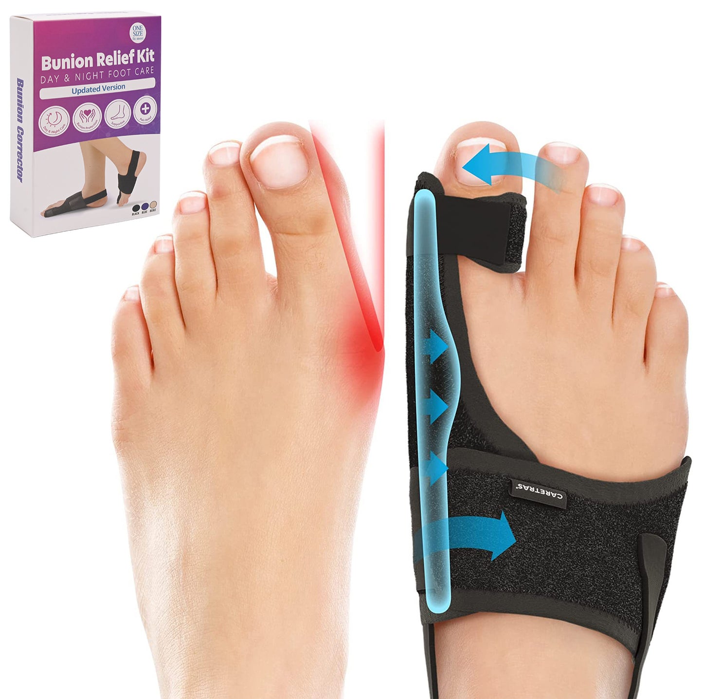 BQ Bunion Corrector